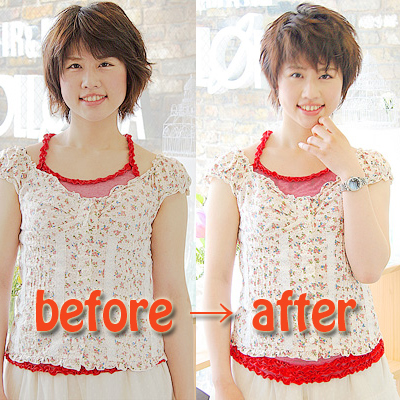 Before&After