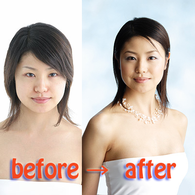 Before&After