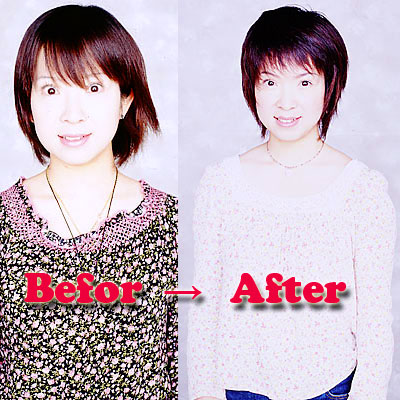 Before&After