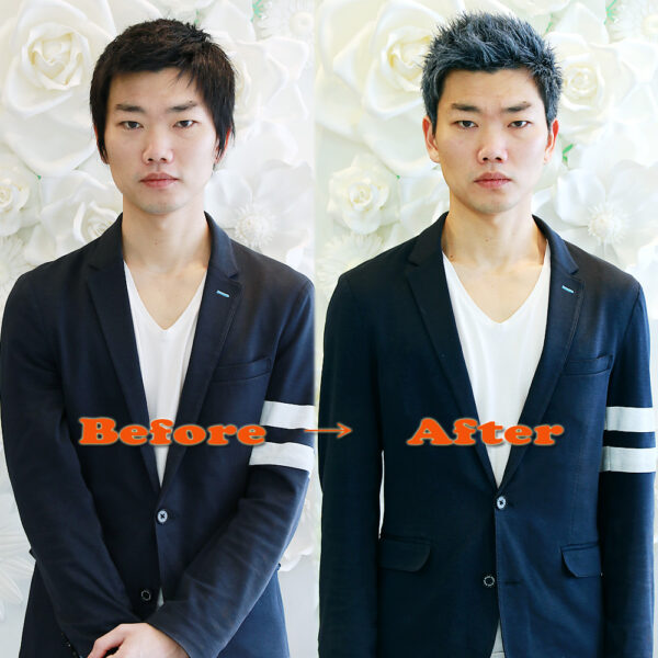 Before&After